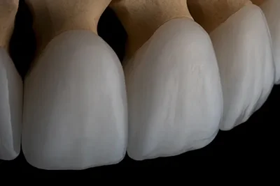Cosmetic Dentistry By Tan Khuu, DDS
