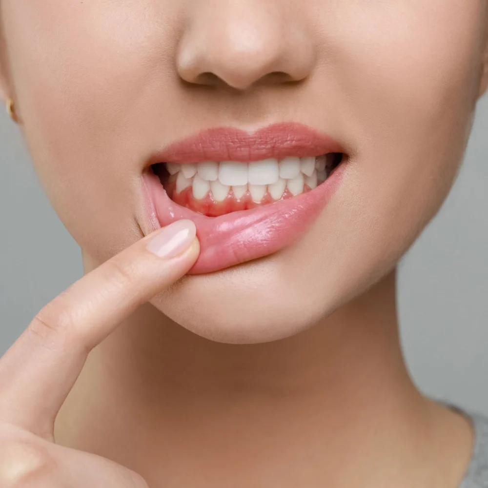 woman with gum disease