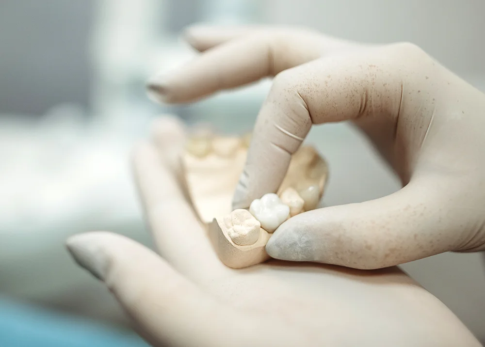 Dentist Holding Lab Crafted Dental Crown